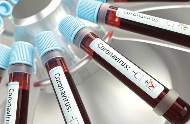 UAE announces 490 new cases, four deaths and 46 fatalities